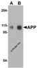 Western blot analysis of APP in mouse brain tissue lysate with APP antibody at (A) 0.5 and (B) 1 μg/ml.